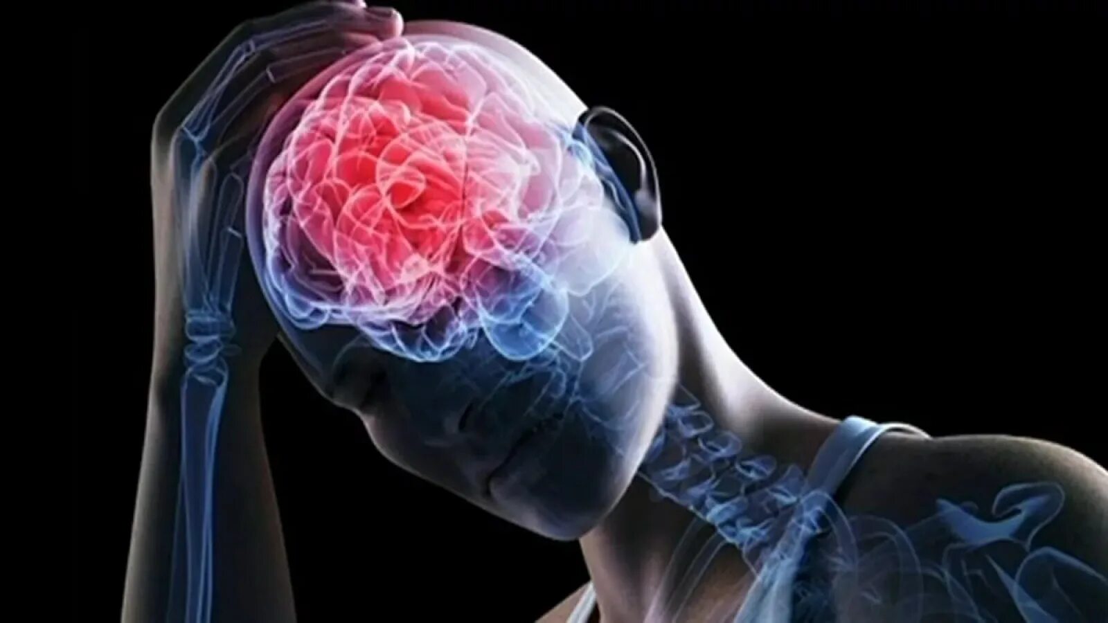 Brain injury. Черепно-мозговая травма. Повреждение головного мозга.