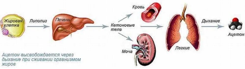Ацетон в организме человека причины. Пероральное отравление ацетоном. Ацетон в организме что это. Ацетон в организме что это. Ацетон в организме человека.
