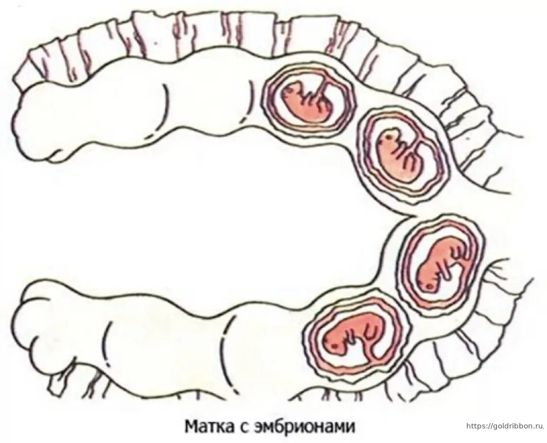 Беременна ли сука. Матка собаки с эмбрионами. Расположение щенков в матке. Матка беременной собаки. Анатомия беременной собаки.