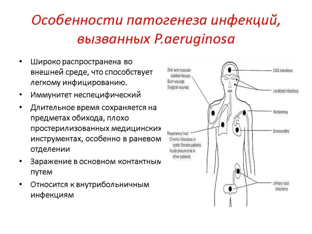 Патогенез синегнойной палочки схема. Механизм развития синегнойной палочки. Болезни вызываемые синегнойной палочкой. Патогенез синегнойной палочки. Признаки патогенеза