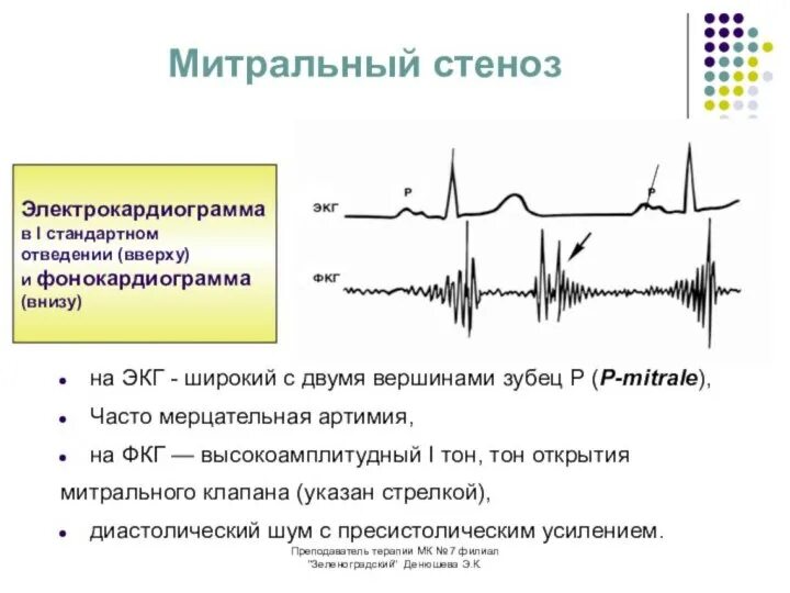 Графическое изображение фкг