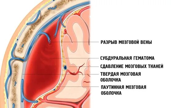 Что значит эпи. Что значит эпи