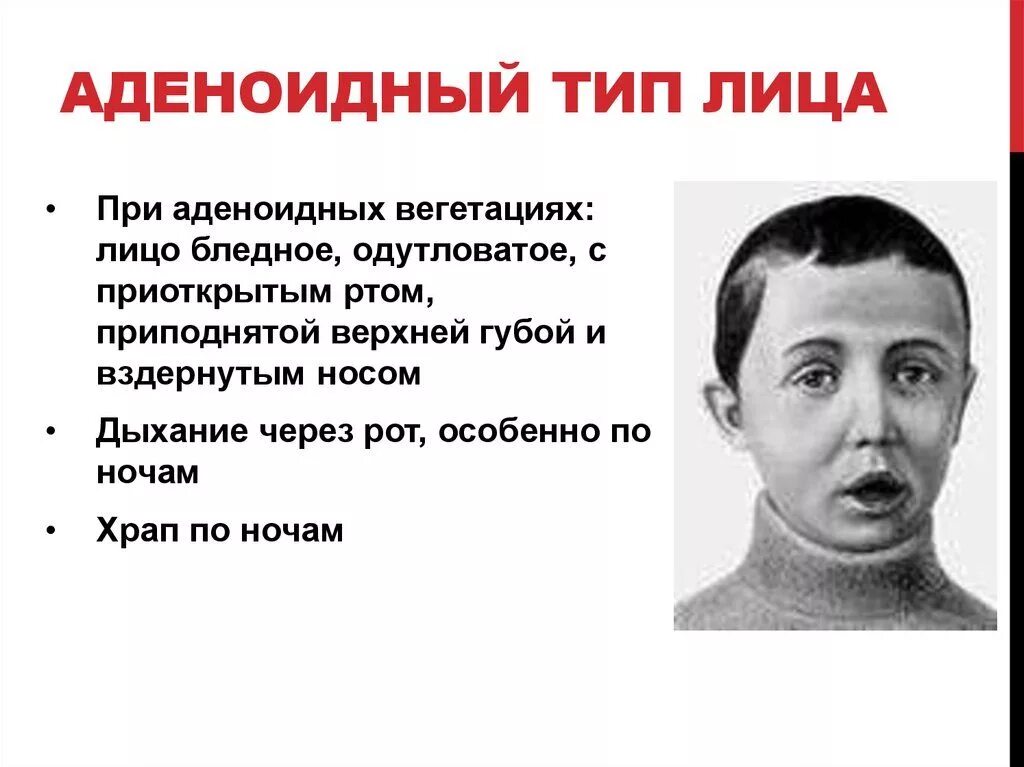 Почему спишь с открытым ртом причины