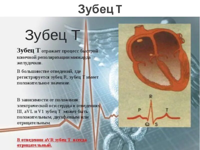 Диффузные нарушения процессов реполяризации левого желудочка. Зубец т отражает процессы. Зубец т в норме. Нарушение процессов реполяризации. Отрицательный зубец t.