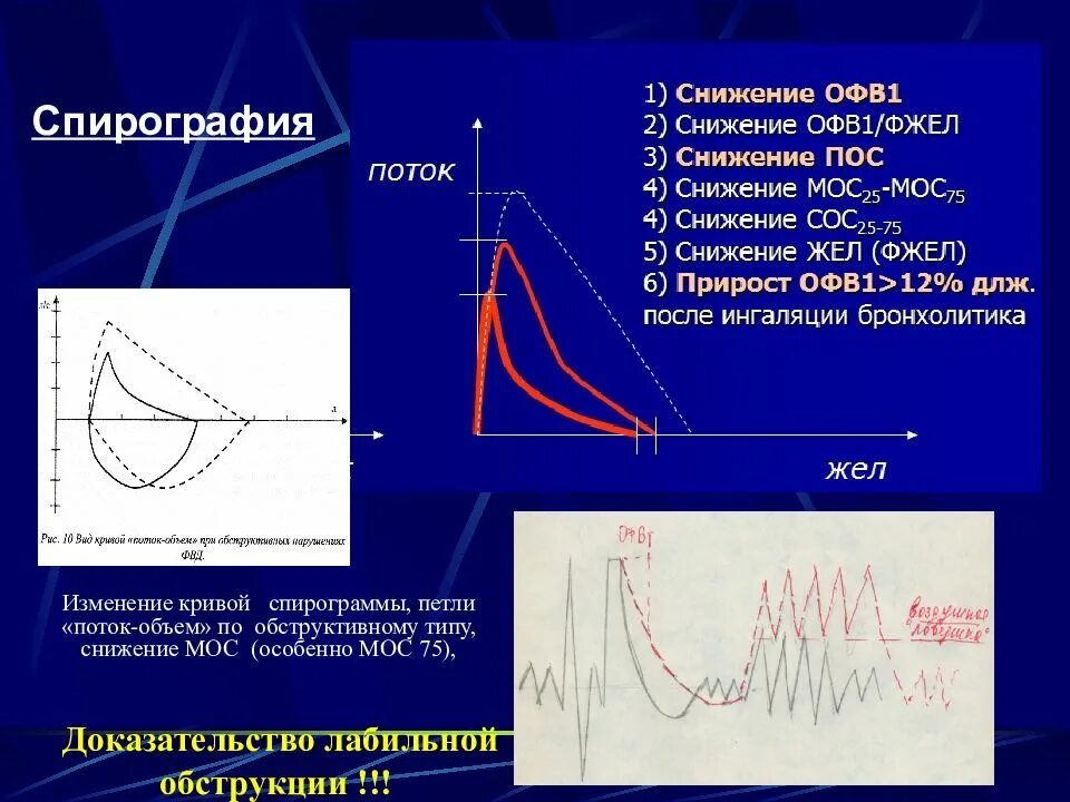 Данные спирографии