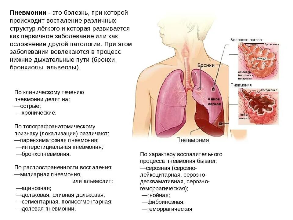 Бронхит переохлаждение. Заболевание пневмония.