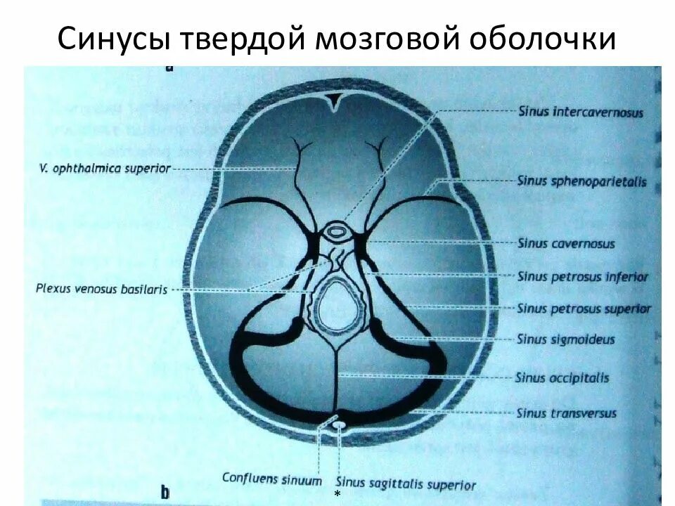 Синусы твердой оболочки мозга. Венозные синусы твердой мозговой оболочки. Пазухи твердой мозговой оболочки схема. Сигмовидный синус головного мозга. Венозные синусы головного мозга схема.