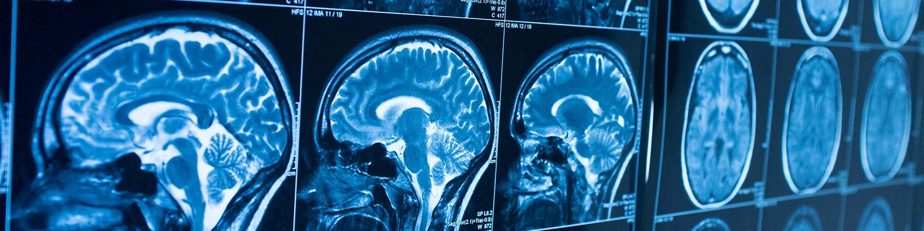 Мрт головного мозга и сосудов новосибирск цены. Мрт головы. Снимок мрт головы с высоким разрешением. Мрт головного мозга Эстетика. Мрт головного мозга gif.