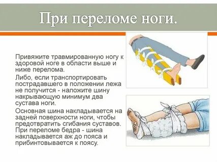 Действие при переломе голени