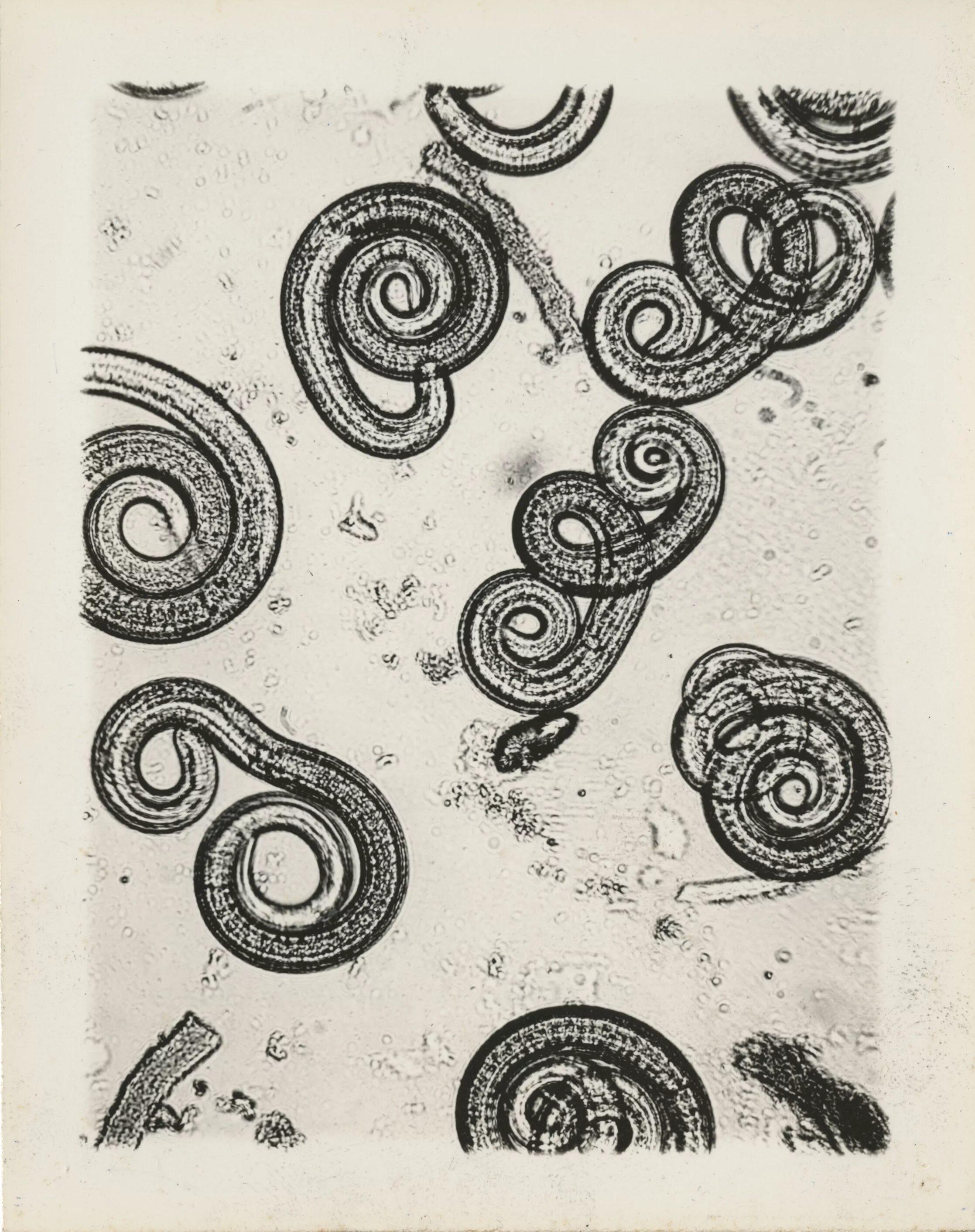 Трихинелла (Trichinella spiralis).