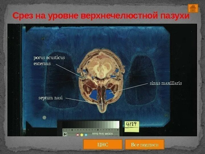 Срез работ. Работа на срез. орбита срез без подписей. срезы на виджетах.