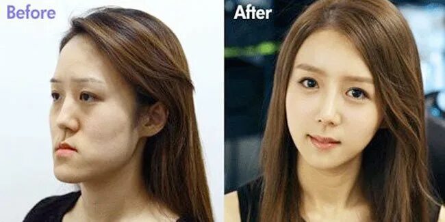 Пак мин ен до и после пластики Crunchyroll Foren Asian Celebrities that had plastic surgery Seite 11
