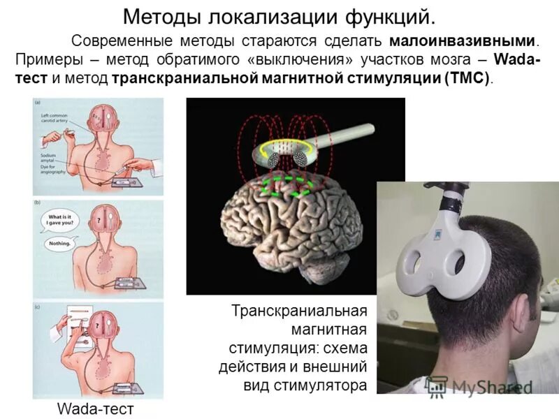 Как стимулировать мозг. Магнитная стимуляция ТМС. Транскраниальная магнитная стимуляция мозга. Транскраниальной магнитной стимуляции. Транскраниальная магнитная стимуляция\ схема.