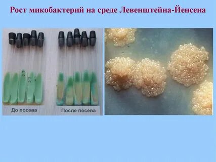 Микобактерии туберкулеза питательные среды
