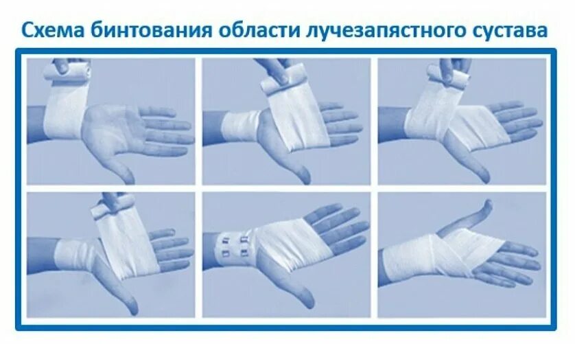 Как правильно эластичным бинтом забинтовать кисть. Перевязка голеностопа эластичным бинтом. Бинтовать голеностоп эластичным бинтом. 5 м) (м-9-30). Техника бинтования эластичным бинтом голени.