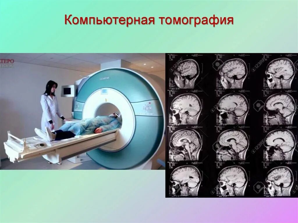 Компьютерная томография в неврологии. Первый компьютерный томограф. Интернет компьютерная томография. Компьютерные томографы модели.
