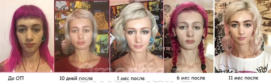 Правильное исправление прикуса в Ярославле - Стоматологический Центр Надежда