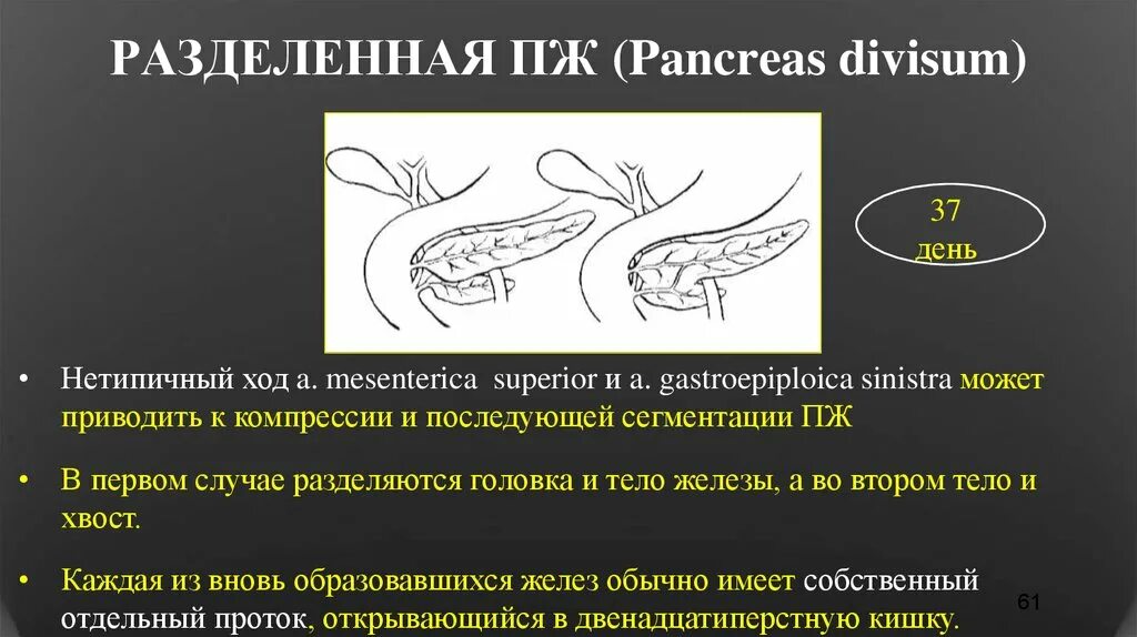 Поджелудочная железа узи норма у мужчин. Divisum поджелудочной железы. Расщепленная поджелудочная железа. Разделенная поджелудочная железа. Разделенная поджелудочная железа УЗИ.