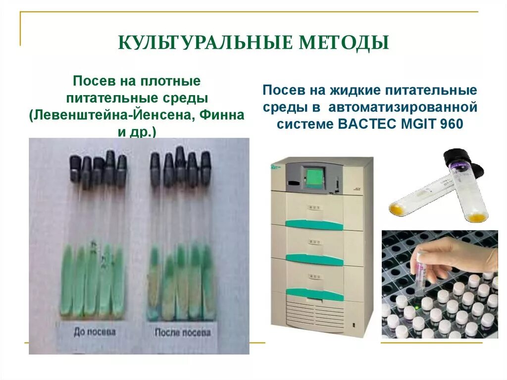 Плотная и жидкая среда. Посев на Левенштейна Йенсена. Микобактерии на среде Левенштейна Йенсена. Среда Левенштейна-Йенсена туберкулез. Среда Финна и Левенштейна Йенсена.