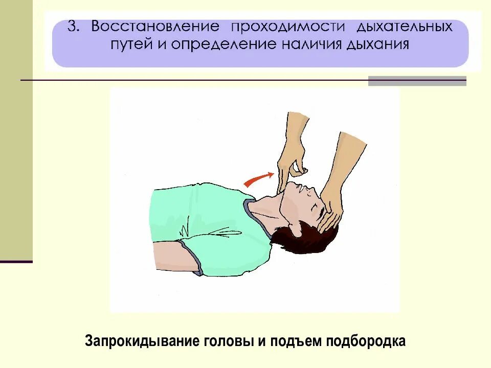 Проведение мероприятий по восстановлению проходимости дыхательных путей. Восстановление проходимости дыхательных путей. мероприятия по восстановлению проходимости дыхательных путей. запрокидывание головы. запрокидывание головы с подъемом подбородка.