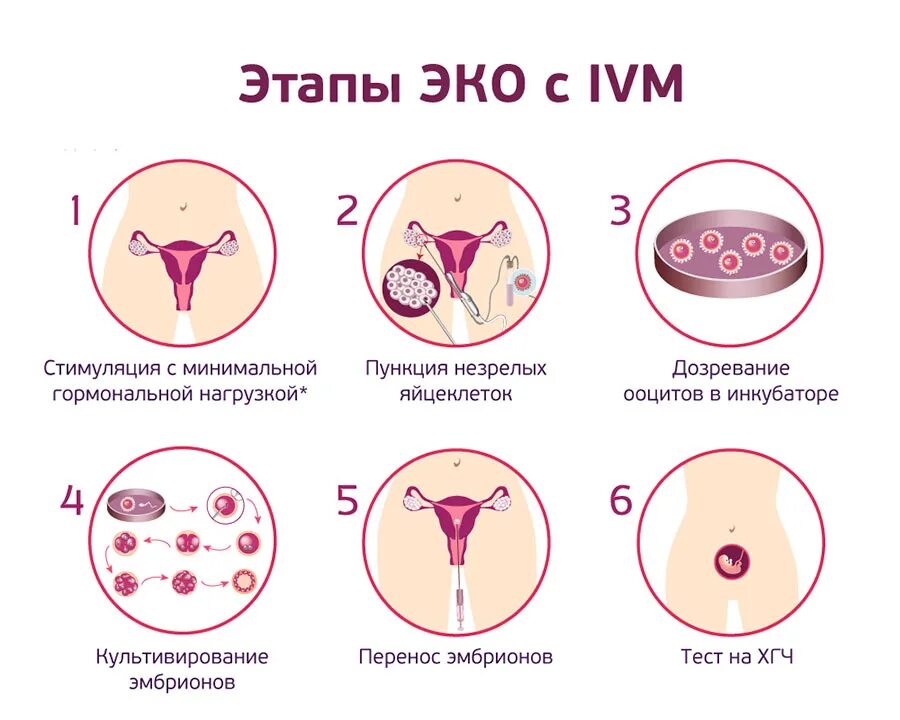 До скольки лет можно эко. Оплодотворение яйцеклетки эко. Этапы экстракорпоральное оплодотворение. Эко оплодотворение как происходит. Этапы экстракорпорального оплодотворения.