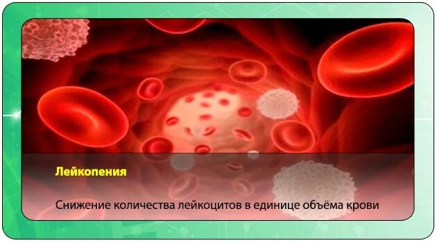 Лейкопения при анемии. Снижение лейкоцитов. Снижены лейкоциты в крови. Лейкопения в крови. Понижение лейкоцитов в крови.