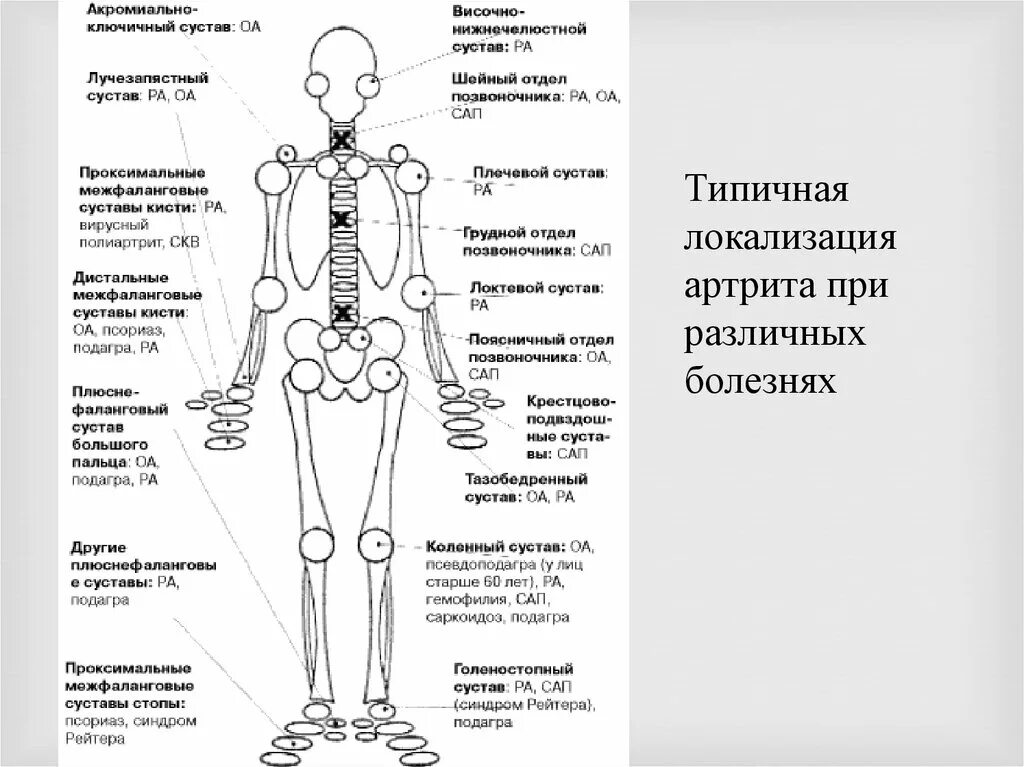 Схема локализации суставов человека. Название суставов. Локализация остеоартроза. Название суставов человека.