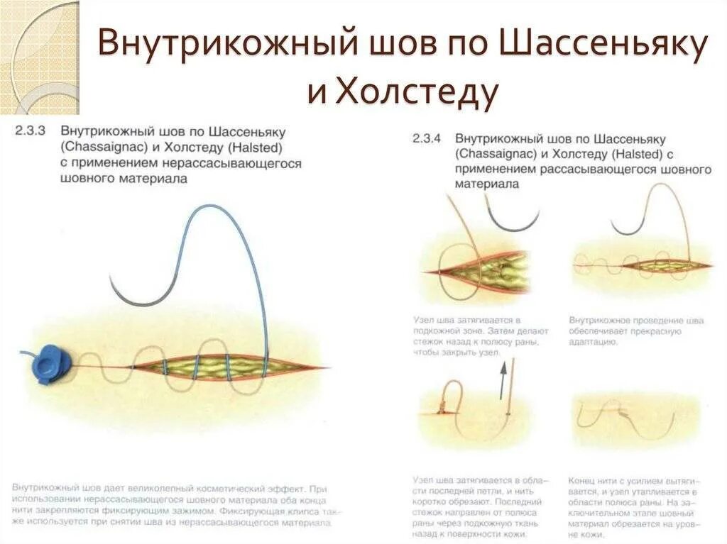 Как долго обрабатывать швы
