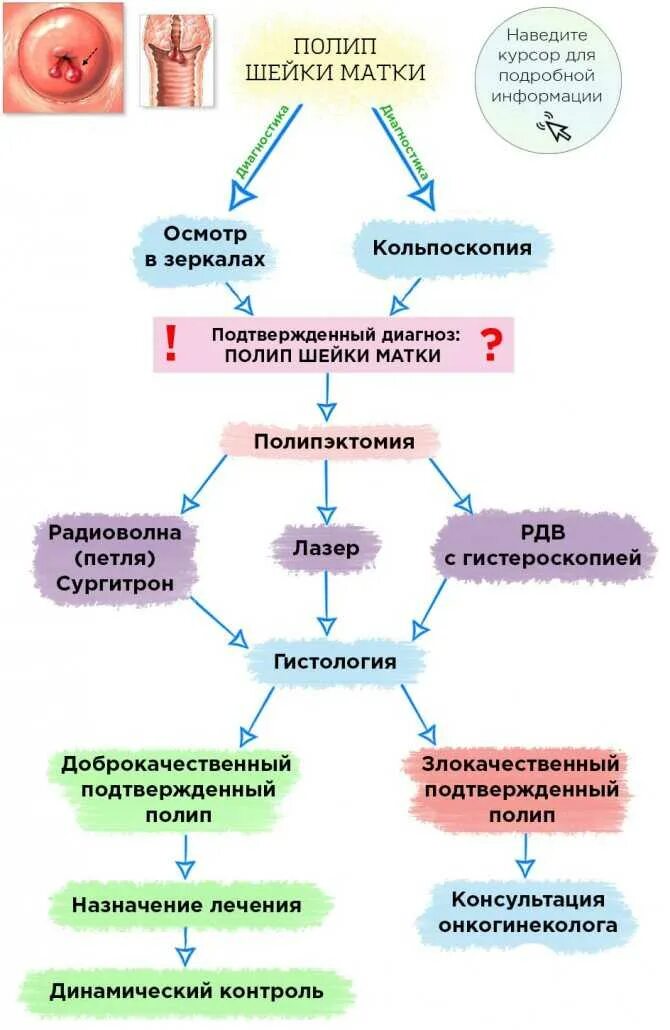 Удаление полипа в матке как проходит операция. Полипы шейки матки классификация. причины появления полипа на шейке матки. полипы в матке причины появления.