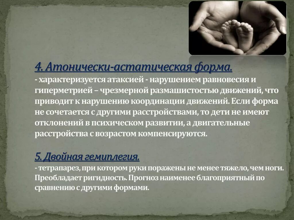 Дцп атонически астатическая. Атонически-астатическая форма дцп симптомы. атоническая астатическая форма дцп. детский церебральный паралич атонически-астатическая форма. атонико-астатический синдром.