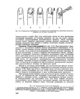 Антибиотик при панариции