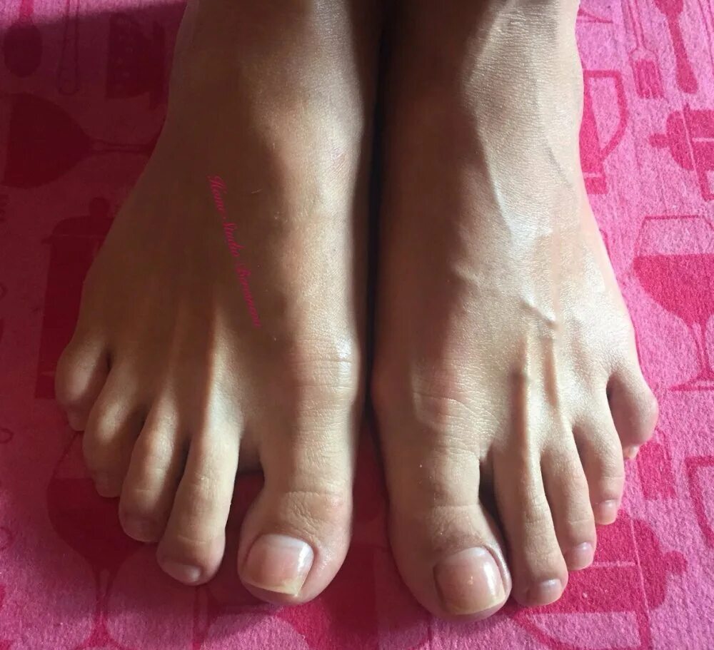 фото ноги без пальца