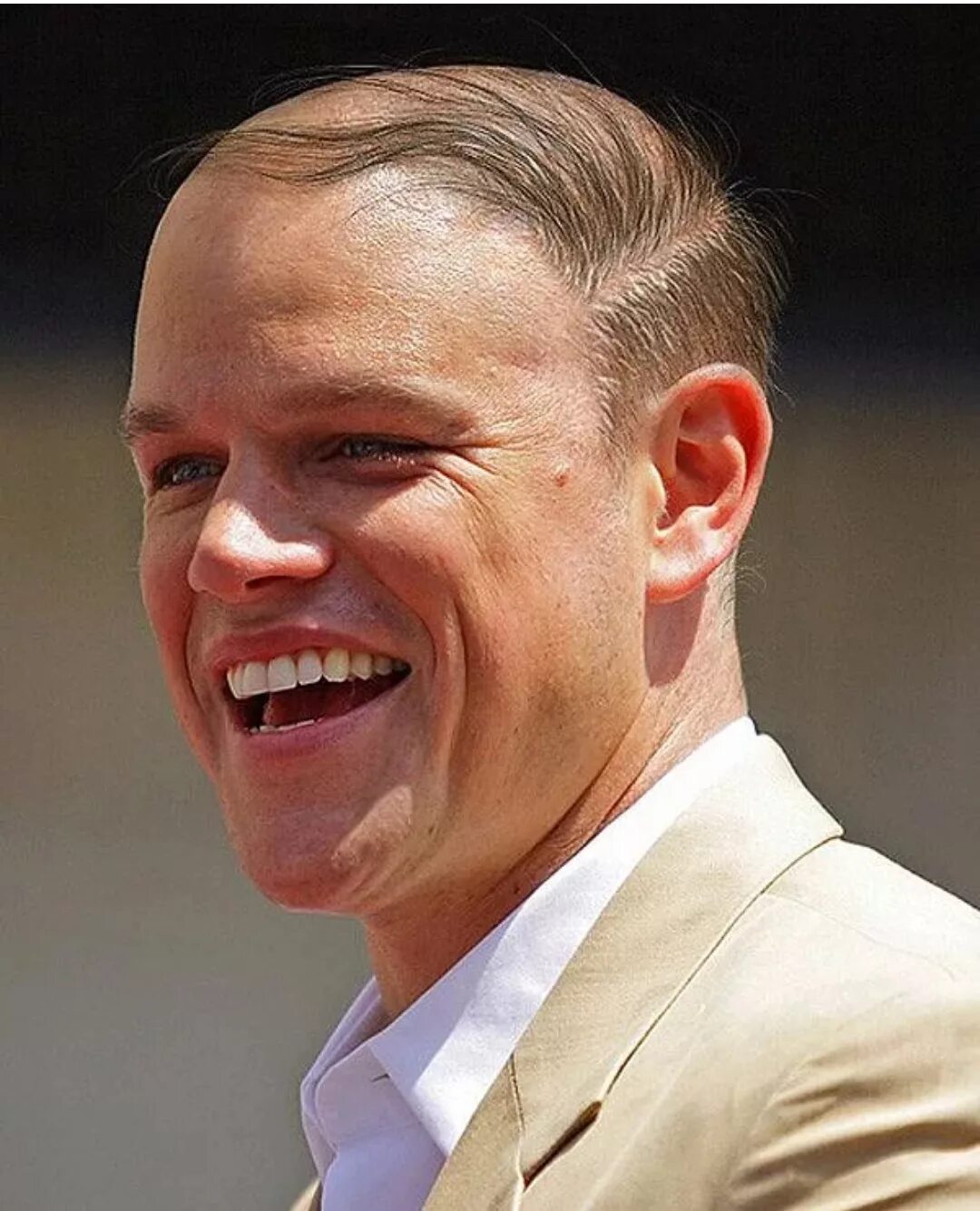 50 Best Hairstyles for a Receding Hairline (Extended) Haircuts for balding men, 