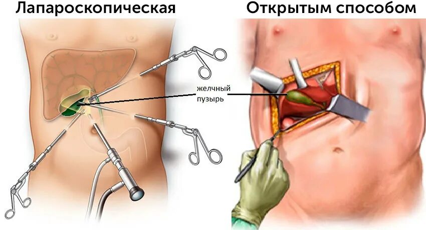 Как называется удаление по медицински