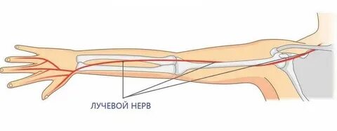 Поражение сенсорных волокон срединного нерва