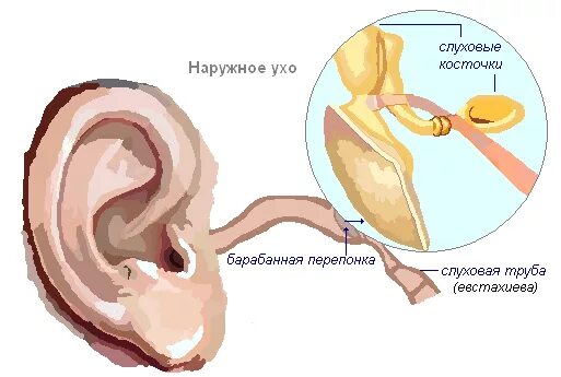 Барабанная перепонка отит. Барабанная перепонка воспринимает звук. Барабанная перепонка строение. Протез барабанной перепонки. Воздух заполняет наружное ухо