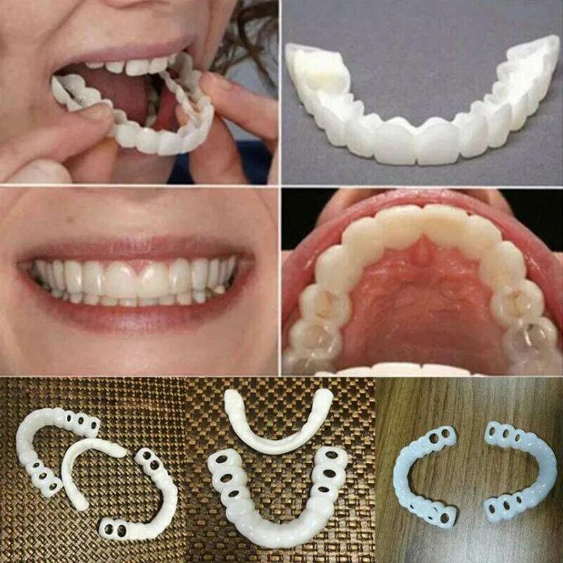 Виниры trusmile veneers. Имплантация mdi (мини-имплантат). Виниры для зубов snapon smile. Можно ли использовать съемный. Частичный съемный пластиночный протез.
