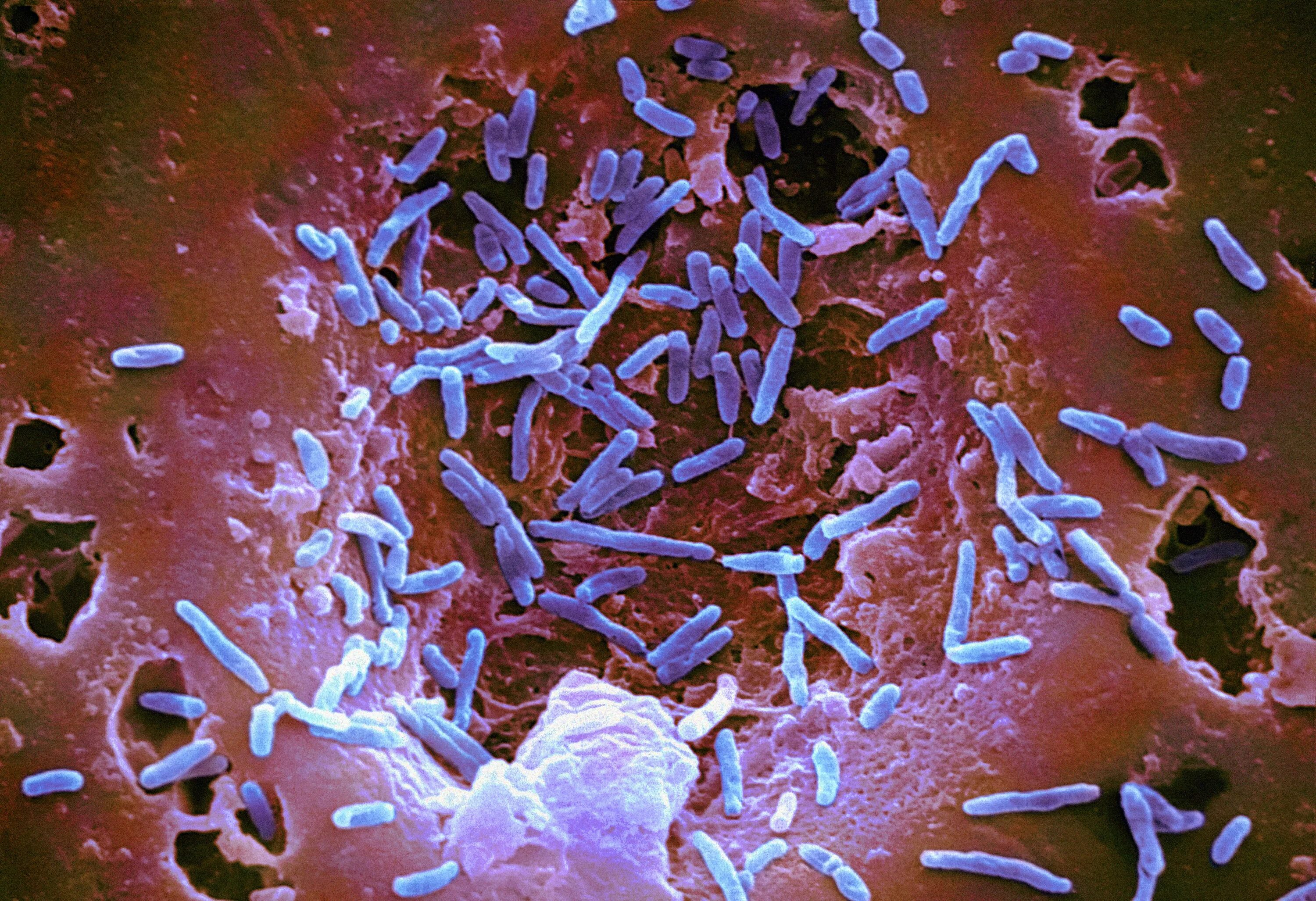 Заболевание туберкулез вызывают бактерии. Бактерия Mycobacterium tuberculosis. Mycobacterium smegmatis. Микобактерии туберкулеза под микроскопом.