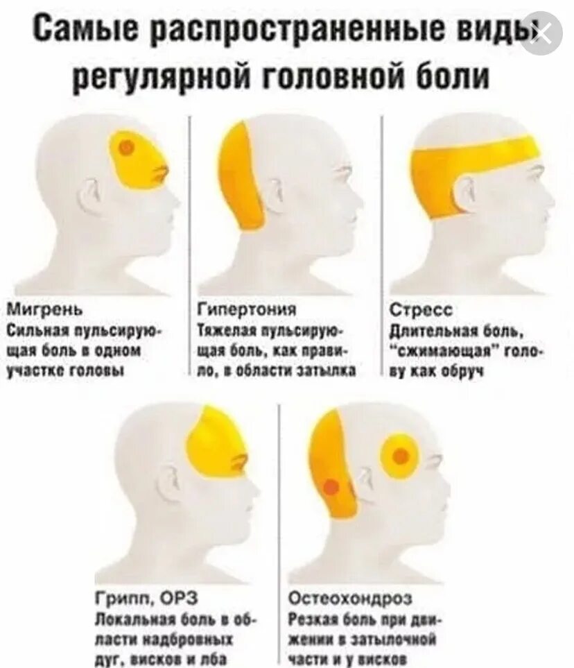 При нагрузке болит голова. Головная боль. Типы головной боли. Головная боль локализация. Причины головной боли.