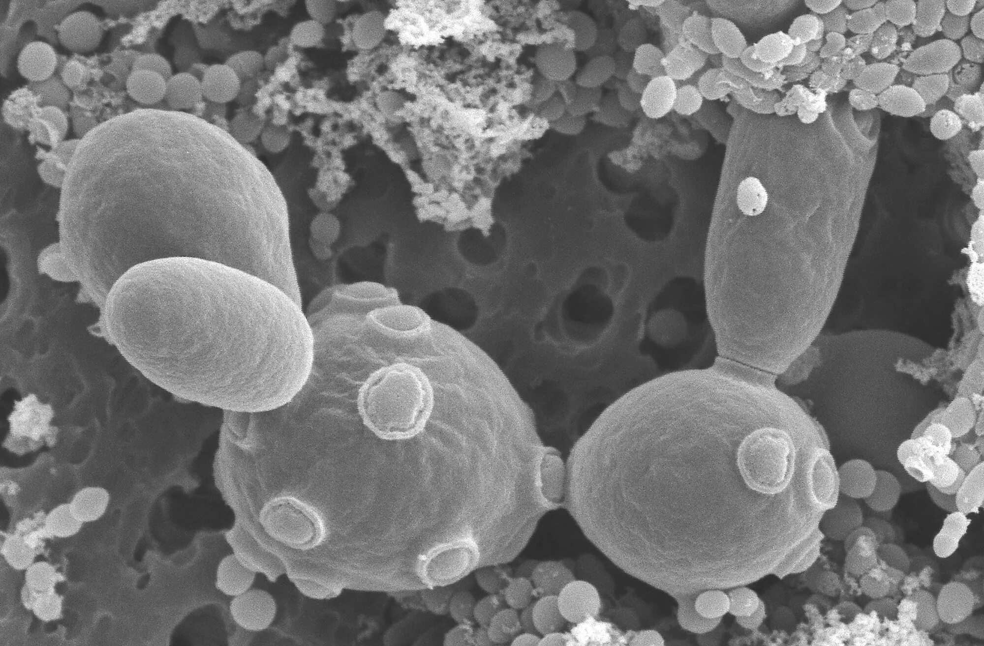 Дрожжи живые организмы. Дрожжи Saccharomyces cerevisiae. Saccharomyces cerevisiae микроскопия. Дрожжей Saccharomyces cerevisiae микроскопия. Saccharomyces cerevisiae строение.