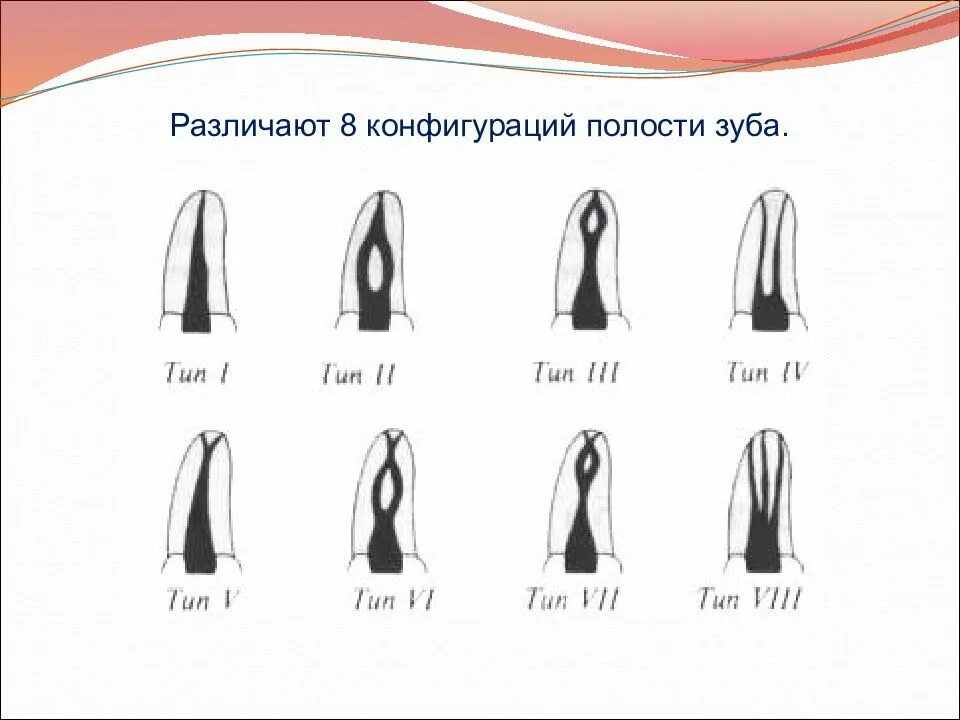 8 Конфигураций полости зуба. Классификация типов корневых каналов зубов.. Зубы корневые каналы топография. Анатомо-топографическое строение полостей и каналов зубов.