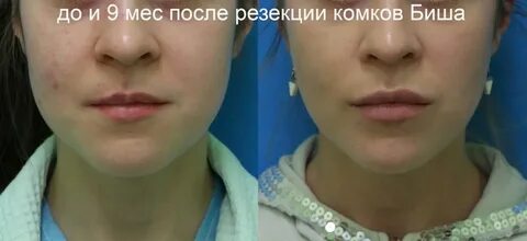 Фото после удаления