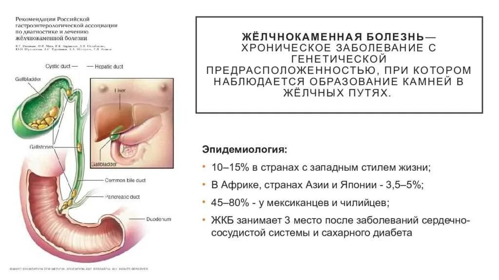 Жкб хирургия. Холедохолитиаз презентация. Холедохолитиаз симптомы. Холедохолитиаз осложнения.