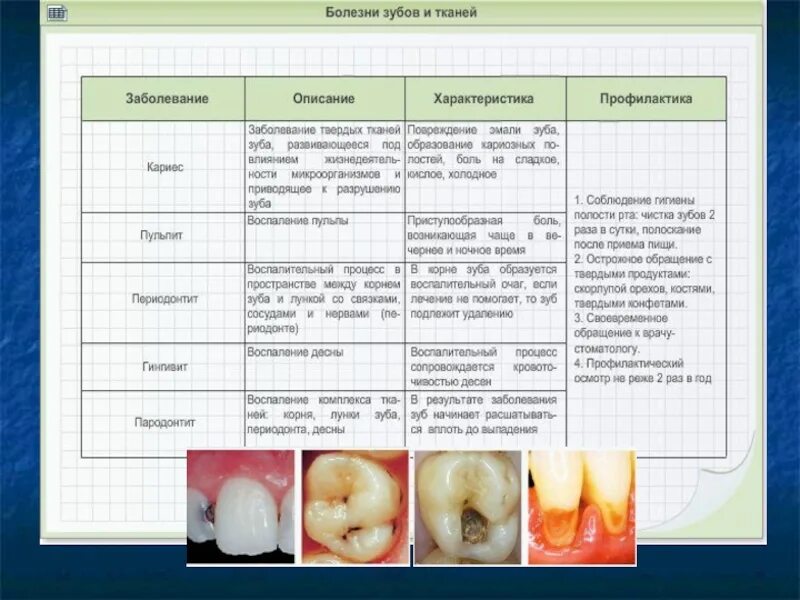 Заболевание зубов таблица. Таблица по заболевания зубов.
