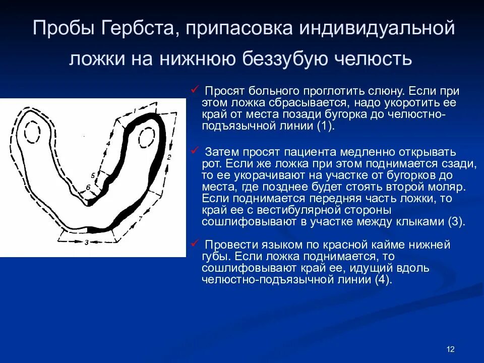 Функциональные пробы по гербсту. Слепки. функциональные пробы гербст. функциональные пробы в ортопедической стоматологии. индивидуальная ложка пробы гербста. функциональные пробы гербста на верхней челюсти.