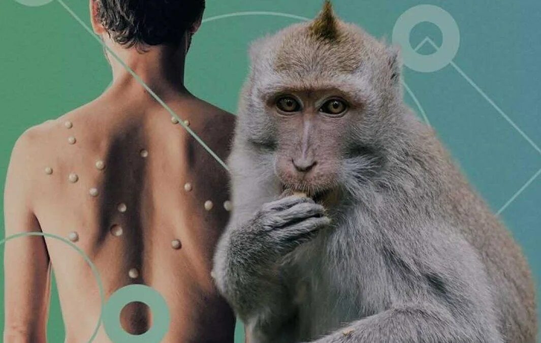 Как распространяется оспа обезьян. Как распространяется оспа обезьян