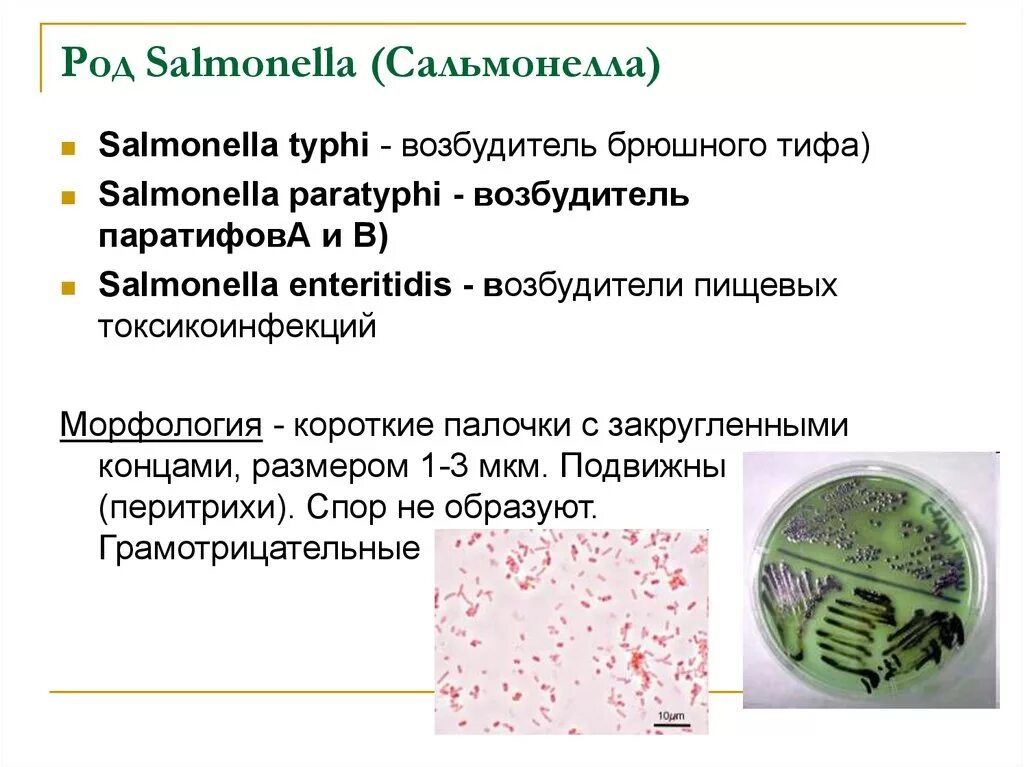 Инфекция латынь. Сальмонелла Тифи морфология. Возбудитель сальмонеллеза микробиология. Возбудитель брюшного тифа микробиология. Сальмонелла Тифи возбудитель микробиология.