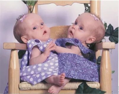 Twins 1