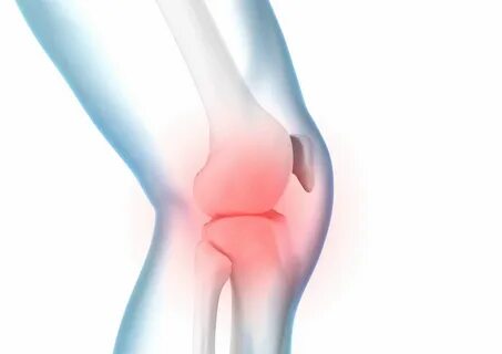 Knee joint effusion - causes, symptoms and treatment