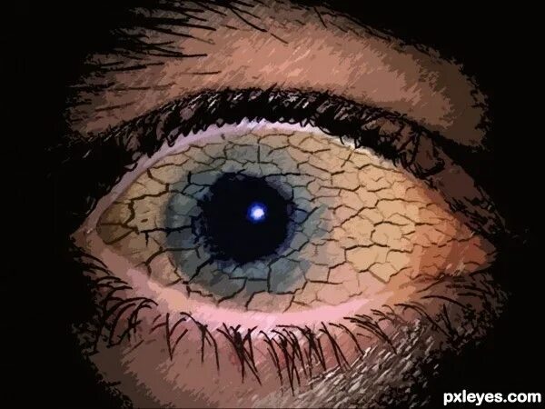 Pin on Eye